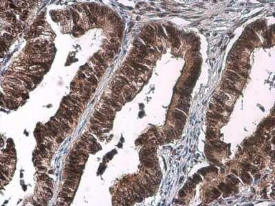 Immunohistochemistry-Paraffin: CDK2 [p Thr160] Antibody [NBP3-13301]